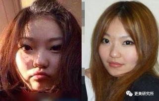 爆料小猪整容视频大全,整容前后对比视频大盘点